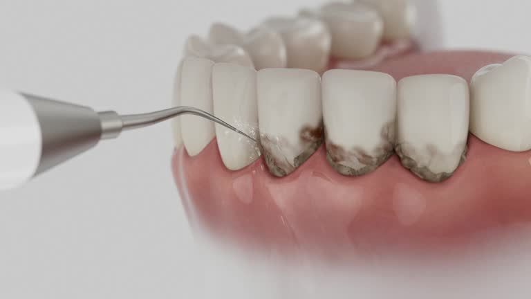 Trusted Dental Crowns And Bridges service in Sherman, IL - Dentist Open Now